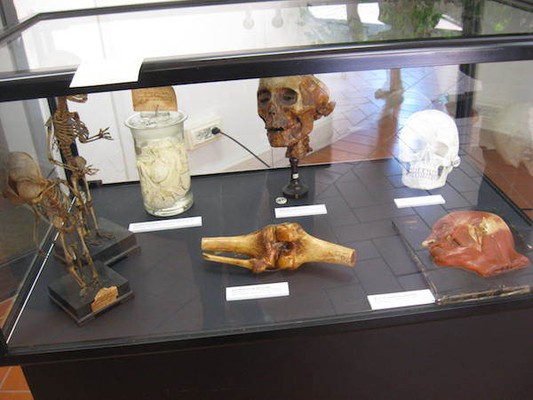 Museo Anatomico “Giovanni Tumiati” 